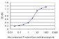 QPCT Antibody (monoclonal) (M01)